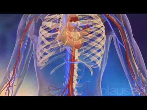 Видео о препарате Бусульфан (аналог Милеран) таблетки 2мг №25